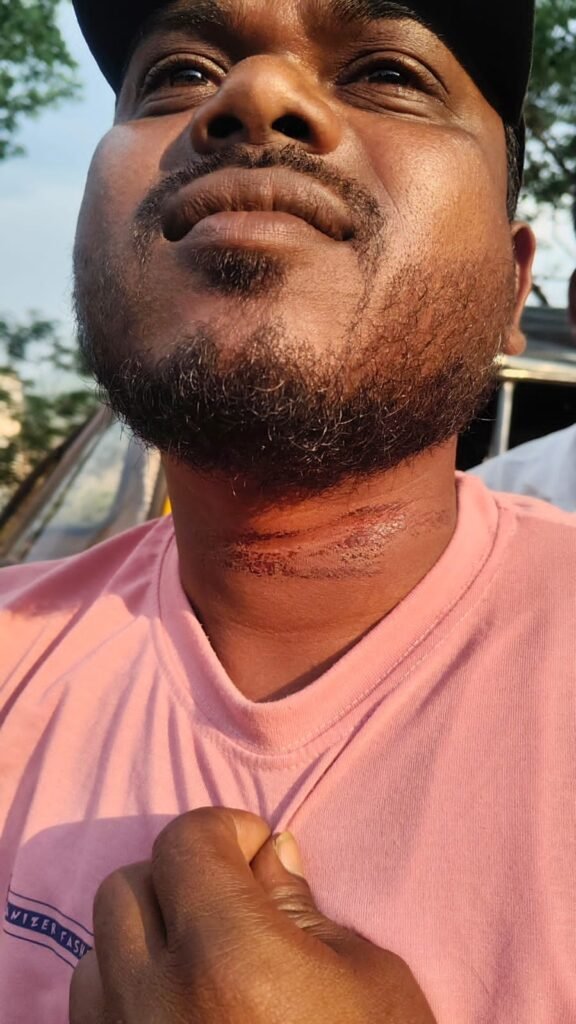 పండగ తెచ్చిన ప్రమాదం..! తాడుకు ఢీకొన్న యువకుడు – తృటిలో తప్పిన విషాదం