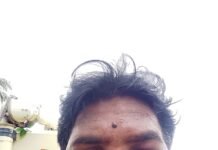 టిడిపి పార్టీ కార్యకర్తపై దాడి ఆరోపణలు