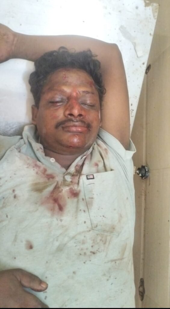 మోటార్ సైకిల్ అదుపుతప్పి వ్యక్తికి గాయాలు….