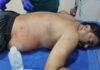 ఆలయ కమిటీ వివాదం.. వ్యక్తిపై కత్తితో దాడి