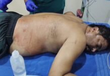 ఆలయ కమిటీ వివాదం.. వ్యక్తిపై కత్తితో దాడి
