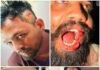 విజ్ఞేశ్వర కాలనీలో అన్నదమ్ములపై దాడి